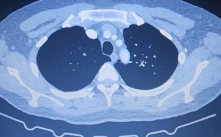 ĐAU BẮP CHÂN DẤU HIỆU BỆNH NGUY HIỂM