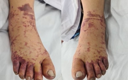 NGƯỜI BÁN THỊT NHIỄM LIÊN CẦU LỢN