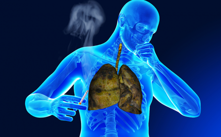 CÁC NGUY CƠ VÀ CÁCH PHÒNG NGỪA LAO PHỔI