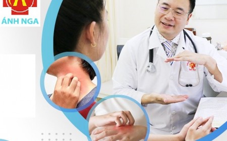 Bác Sĩ Nguyễn Ngọc Ánh Giải Đáp: Bệnh Sán Chó Toxocara Có Lây Từ Người Sang Người Không?