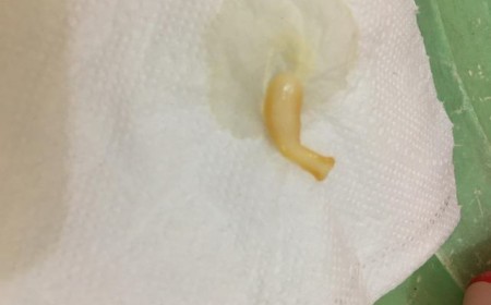 Cảnh báo những loại thực phẩm có thể khiến bạn ôm hận vì sán xơ mít