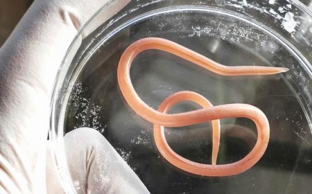 Bệnh giun đũa Ascaris lumbricoides: Nguyên nhân lây truyền và cách điều trị hiệu quả