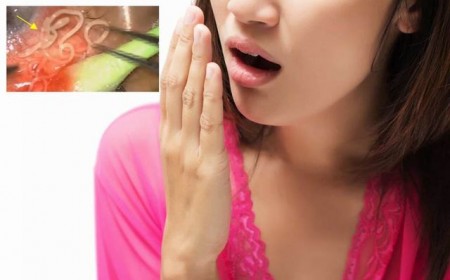 Trị Bệnh Hôi Miệng Do Nhiễm Ký Sinh Trùng Giun Sán