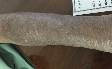 Điều Trị Bệnh Sán Chó Tại Phòng Khám Bệnh Giun Sán Ánh Nga