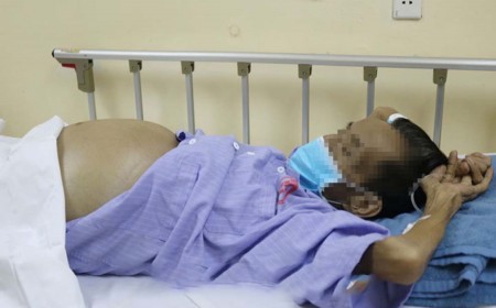 Điều Trị Sán Chó Toxocara: Khi Nào Cần Tái Khám Và Có Nên Uống Thuốc Nam Thay Thuốc Tây?