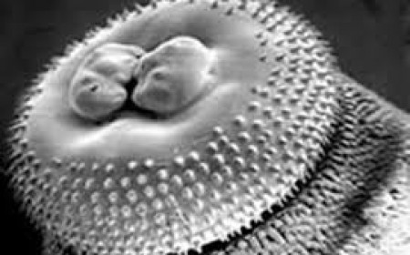 Tác Nhân Gây Bệnh Giun Đầu Gai Ở Người