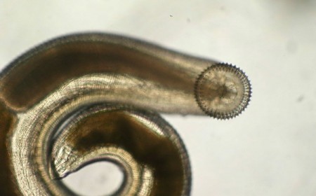 Giun Đầu Gai Gnathostoma: Nguyên Nhân, Triệu Chứng Và Điều Trị