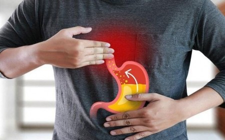 BỆNH TIÊU HÓA THƯỜNG GẶP TRONG TẾT