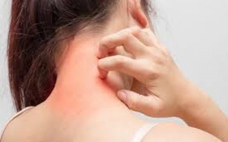 Những Nguyên Nhân Thường Gặp Của Bệnh Sán Chó