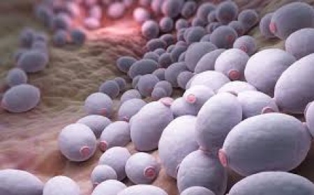 Chẩn Đoán Và Điều Trị Bệnh Nấm Candida