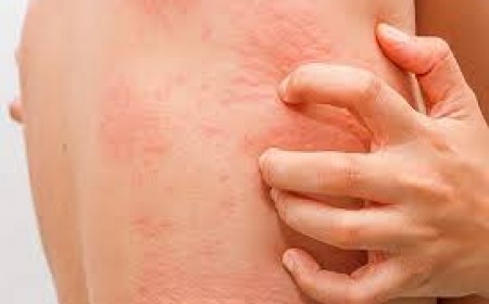 Những dấu hiệu bị ngứa da do dị ứng