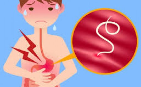 Những Điều Cần Biết Về Giun Hình Ống