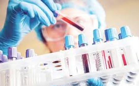 Quy Trình Tìm Giun Đũa Chó Bằng Phương Pháp Elisa