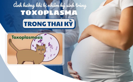 Ký Sinh Trùng Mèo Toxoplasma: Phân Biệt IgM Và IgG