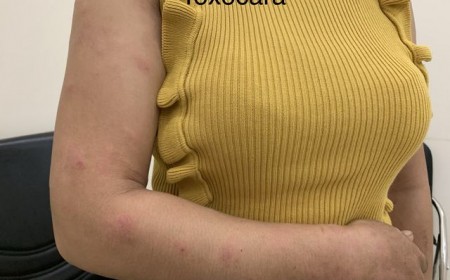 Muốn Trị Dứt Điểm Bệnh Sán Chó Thì Phải Làm Sao?