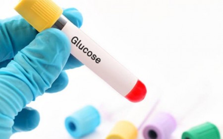 Xét Nghiệm Đường Glucose Trong Máu