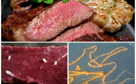 Điều Trị Sán Dây Bò Hiệu Quả Và An Toàn Tại Phòng Khám Ánh Nga