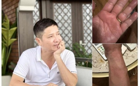 NSƯT Chí Trung mắc bệnh lạ, mất ngủ triền miên