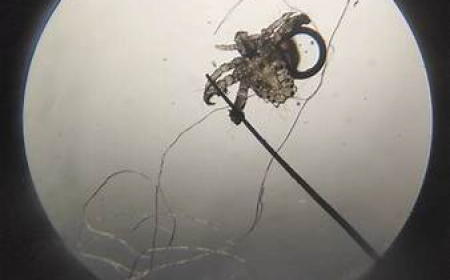 Rận Mu: Nguyên Nhân, Triệu Chứng, Phòng Ngừa Và Cách Điều Trị Hiệu Quả