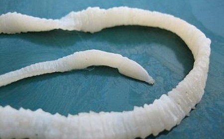 Bệnh Sán Dây Cá, Xét Nghiệm Có Biết Nhiễm Sán Dây Cá Không?