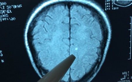 Sán chó cướp đi sinh mạng tràng trai 19 tuổi