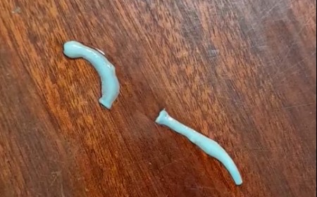 Cách Phòng Tránh Sán Dây Bò Và Những Món Ăn Dễ Nhiễm