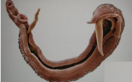 PHƯƠNG PHÁP XÉT NGHIỆM VÀ CÁCH PHÒNG NGỪA SÁN MÁNG