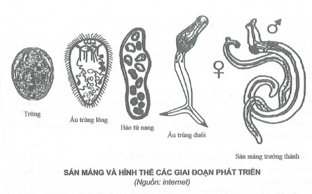 BỆNH SÁN MÁNG LÀ GÌ? CÁC TRIỆU CHỨNG CỦA BỆNH SÁN MÁNG
