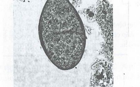 Tại Sao Nhiễm Sán Lá Ruột Lại Gây Suy Nhược Cơ Thể