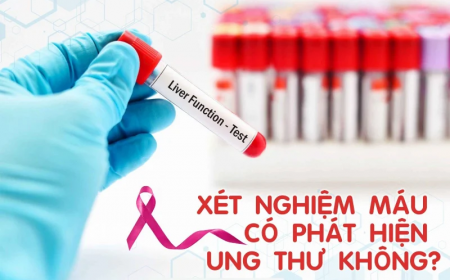 Tôi Năm Nay 40 Tuổi, Cơ Thể Đôi Khi Rất Mệt Mỏi, Ngủ Không Ngon Giấc – Cần Xét Nghiệm Kiểm Tra Những