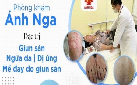 TRIỆU CHỨNG GIUN SÁN CHÓ MÈO