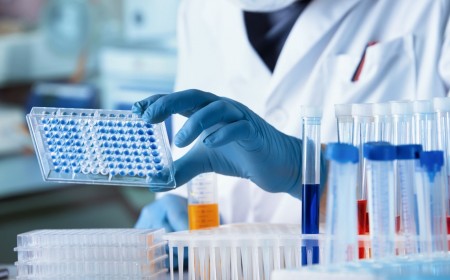 Xét Nghiệm Giun Sán Gây Ngứa Vì Sao Chỉ Cần Lấy Máu?