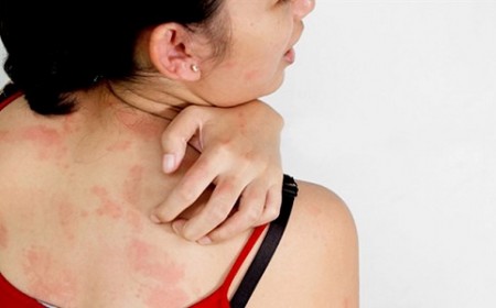 KHI NÀO CẦN LÀM XÉT NGHIỆM KÝ SINH TRÙNG 