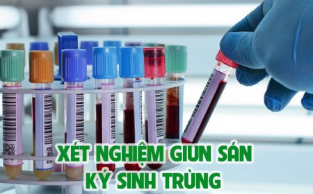 Xét Nghiệm Giun Sán Gồm Những Loại Nào? Chi Phí Bao Nhiêu?