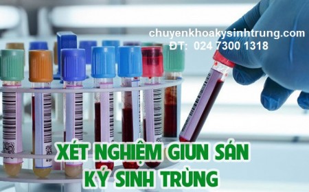 KHI NÀO CẦN LÀM XÉT NGHIỆM KÝ SINH TRÙNG 