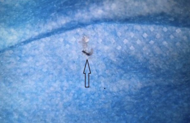 Trị Bệnh Sán Chó Có Khỏi Bệnh Ngứa Da Không?