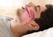 NÃO BỘ CÓ THỂ BỊ TỔN THƯƠNG BỞI TRIỆU CHỨNG NGƯNG THỞ KHI NGỦ