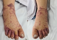 NGƯỜI BÁN THỊT NHIỄM LIÊN CẦU LỢN