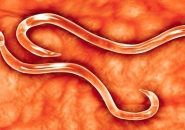 PHÁT HIỆN HÀNG TRĂM GIUN MÓC TRONG RUỘT THIẾU NIÊN