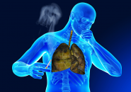 CÁC NGUY CƠ VÀ CÁCH PHÒNG NGỪA LAO PHỔI