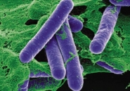 Ngộ Độc Clostridium botulinum