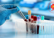 Hiểu Đúng Về Hiện Tượng Dương Tính Giả Sán Chó Toxocara – Tư Tấn Từ Bác Sĩ Nguyễn Văn Đức