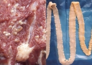 Bệnh Sán Lợn Gạo Taenia Solium: Nguyên Nhân, Triệu Chứng, Phòng Tránh Và Điều Trị Hiệu Quả