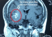 Bị Ngứa Da, Nổi Mề Đay, Dị Ứng Lâu Ngày Cần Làm Xét Nghiệm Gì Tìm Nguyên Nhân?