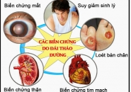 Biến Chứng Của Bệnh Tiểu Đường