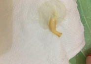 Cảnh báo những loại thực phẩm có thể khiến bạn ôm hận vì sán xơ mít