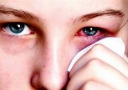 Đau Mắt Đỏ, Nguyên Nhân Và Cách Điều Trị