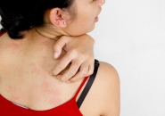 NHẬN BIẾT VÀ CÁCH XỬ LÝ KHI BỊ DỊ ỨNG THỨC ĂN