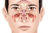 SÓNG ÂM GIÚP ĐIỀU TRỊ VIÊM MŨI XOANG MẠN TÍNH