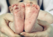 PHÒNG BỆNH KÝ SINH TRÙNG CHO TRẺ